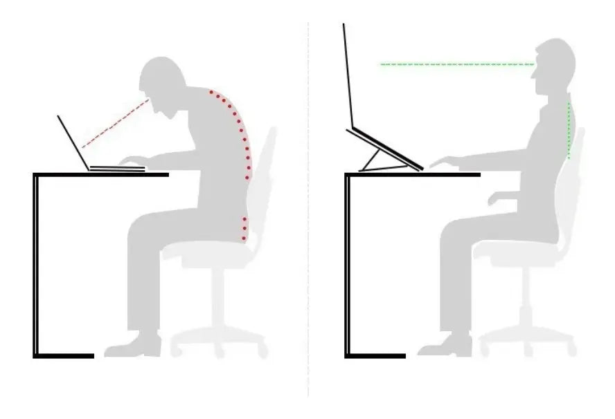Soporte Metálico para Laptop — Ergonómico, Ajustable y Universal