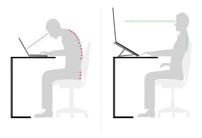 Soporte Metálico para Laptop — Ergonómico, Ajustable y Universal